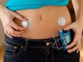 Принадлежности для инъекции инсулина будут выдавать по программе госгарантий