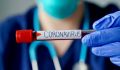 Коронавирусная инфекция: всё, что нужно знать о вирусе
