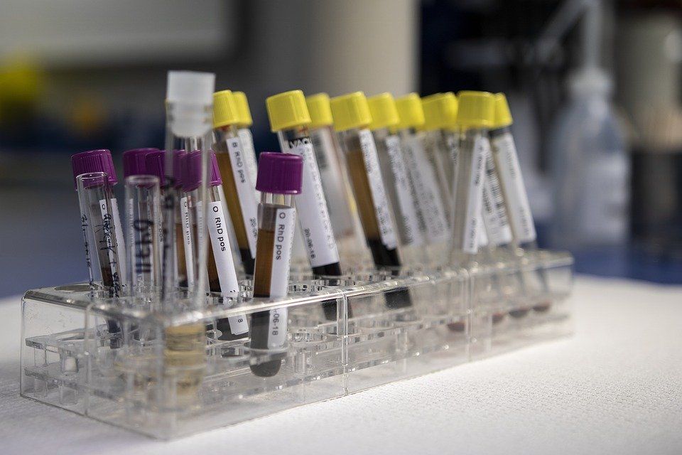 В Севастополе в лаборатории кожно-венерологического диспансера будут делать анализы на коронавирус