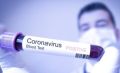 В Крыму 130 человек вылечились от коронавируса
