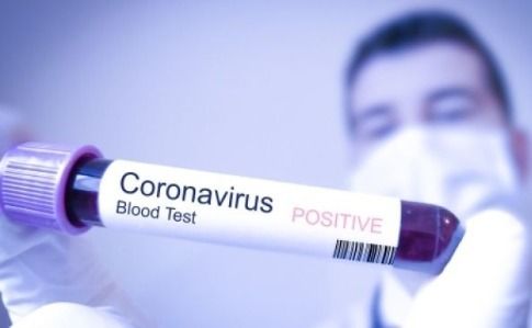 В Крыму 130 человек вылечились от коронавируса