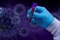 Новый случай коронавируса выявлен у сотрудницы «Массандры»