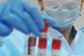 За сутки — 15 новых пациентов с коронавирусом. Ситуация в Крыму