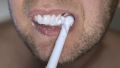 Как безопасно отбелить зубы: советы врача