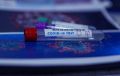 В Крыму выявили 149 новых случаев коронавируса за сутки
