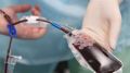 Впервые в истории: британские ученые перелили человеку лабораторную кровь