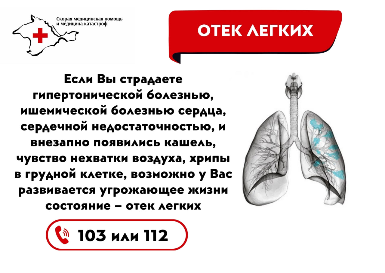 Умение оказать первую помощь — элементарный, но очень важный навык - Лента  новостей Крыма