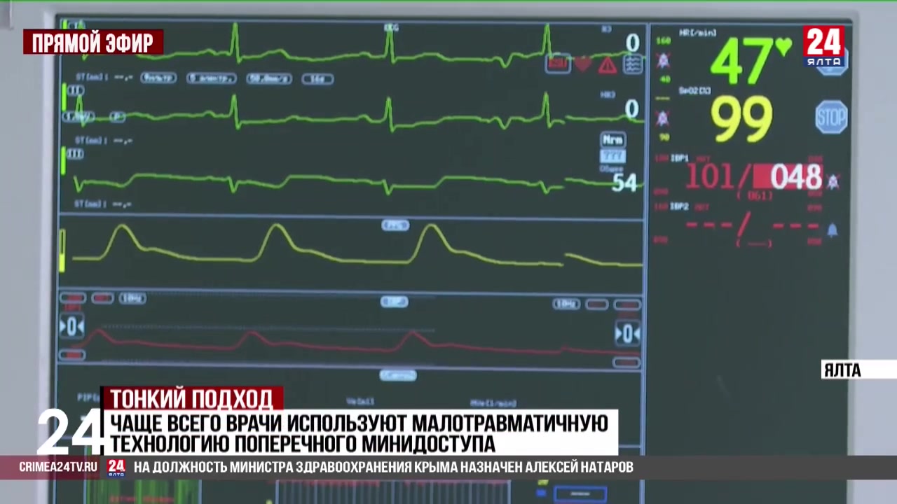 В Ялтинском многопрофильном медицинском центре проводят операции на сонных  артериях - Лента новостей Крыма