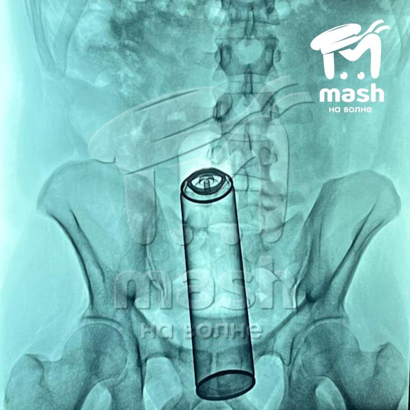 Внимание, вопрос. Что на фото? Где — отвечать не надо