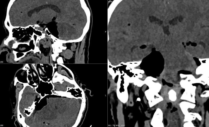 � ����� ������������ ������� � �������� ���������� ������� �����