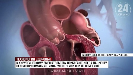 ������� �� ����� ������ �����: ���������� ����������� ��������� ���� ������ ���������� �������� � ������ ���������� ������ ����