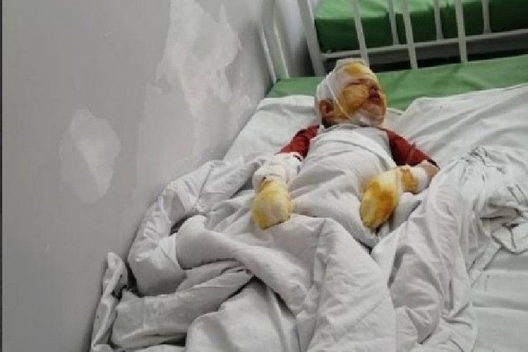 «Хочу лишить его родительских прав!» Отец вывез 4-летнего сына в лес и взорвал рядом с ним газовый баллон «Хочу лишить его родительских прав!» Отец вывез 4-летнего сына в лес и взорвал рядом с ним газовый баллон