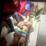 Мужчина упал со скалы и разбил голову на пляже "Инжир"