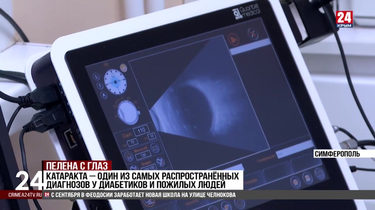 Новый многофункциональный аппарат закупят в офтальмологический центр в этом году