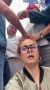 Оттаскала за косу и выдрала волосы: крымчанка из ревности напала на девушку в Алуште