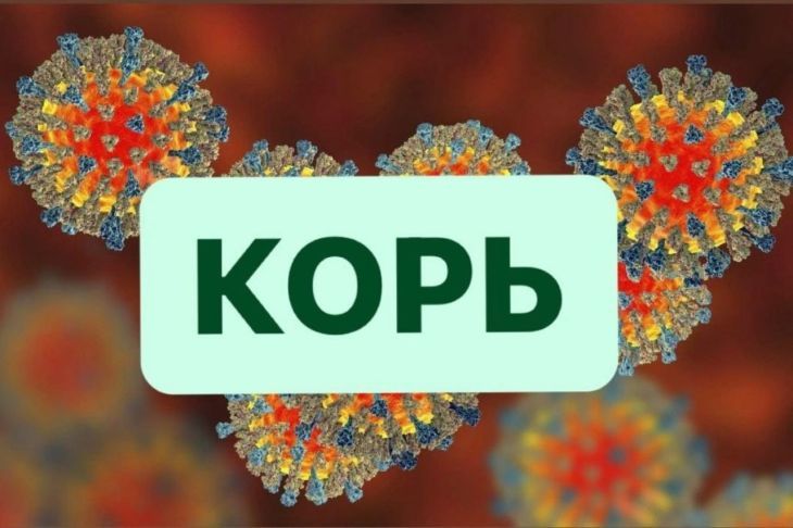 Крымчанам рассказали, чем опасна корь и как избежать болезни